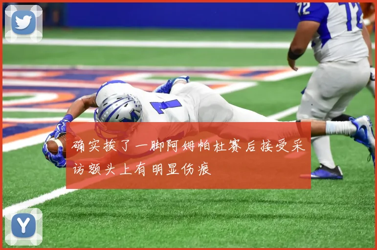 确实挨了一脚阿姆帕杜赛后接受采访额头上有明显伤痕